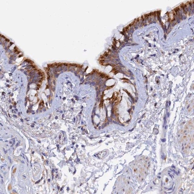 Anti-RPGRIP1L antibody produced in rabbit