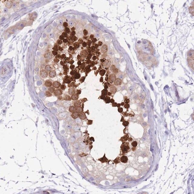 Anti-RPL18 antibody produced in rabbit