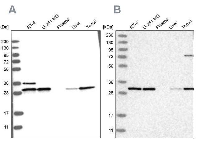 Anti-RPA2 antibody produced in rabbit