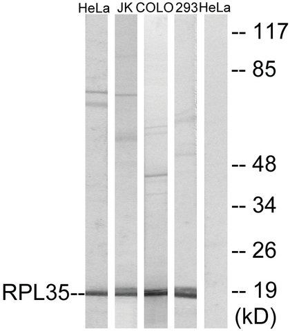 Anti-RPL35 antibody produced in rabbit