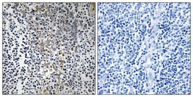 Anti-RPL23 antibody produced in rabbit