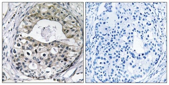 Anti-RPS13 antibody produced in rabbit