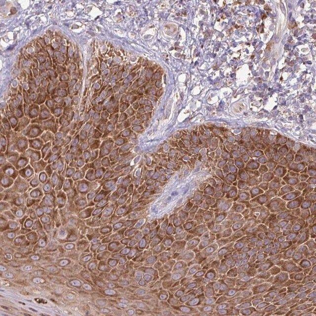 Anti-RPS3 antibody produced in rabbit