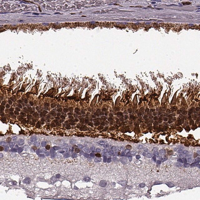 Anti-RCVRN antibody produced in rabbit