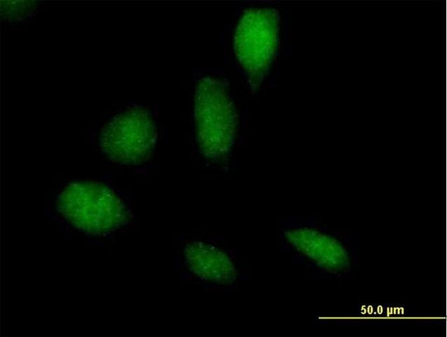 Anti-RECQL5 antibody produced in mouse