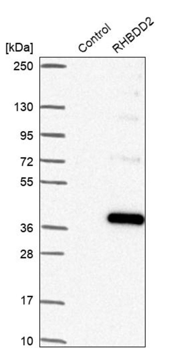 Anti-RHBDD2 antibody produced in rabbit