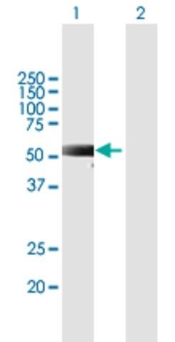 Anti-RKHD2 antibody produced in mouse