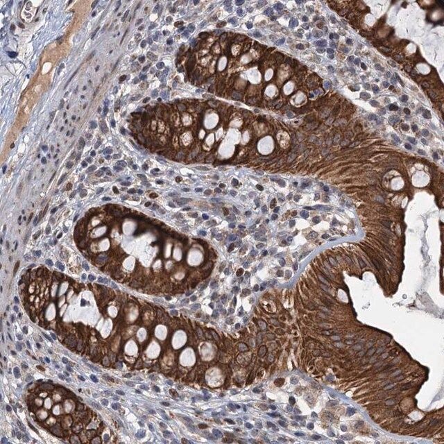 Anti-RITA1 antibody produced in rabbit