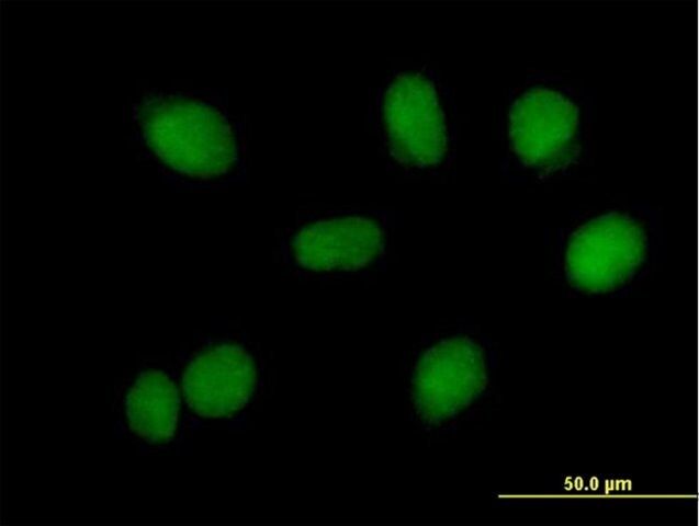 Anti-RMI1 antibody produced in mouse