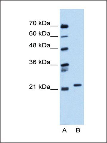 Anti-RAB11B antibody produced in rabbit