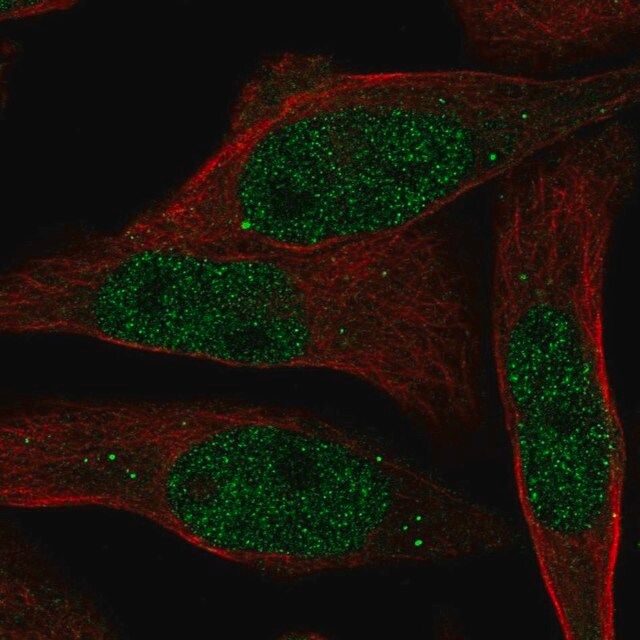 Anti-RAB8B antibody produced in rabbit