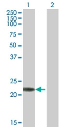 Anti-RAB7B antibody produced in mouse