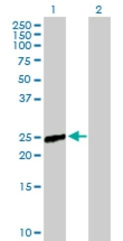 Anti-RAB9B antibody produced in mouse