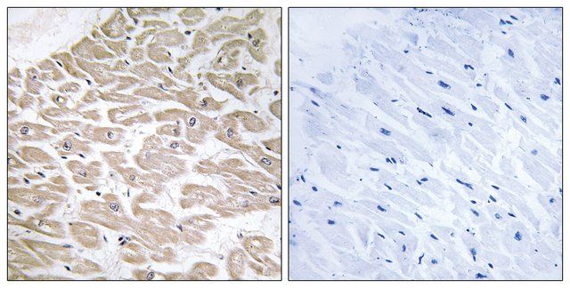 Anti-RAD antibody produced in rabbit