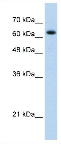 Anti-RAD17 antibody produced in rabbit