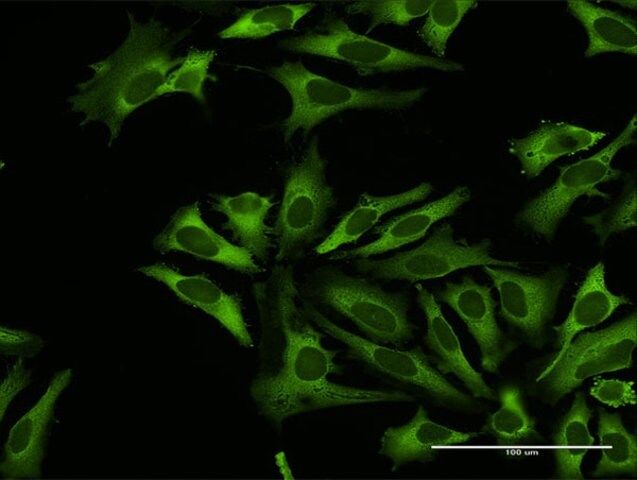 Anti-RARS antibody produced in rabbit