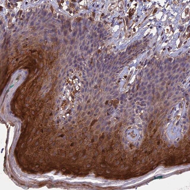 Anti-RASAL1 antibody produced in rabbit