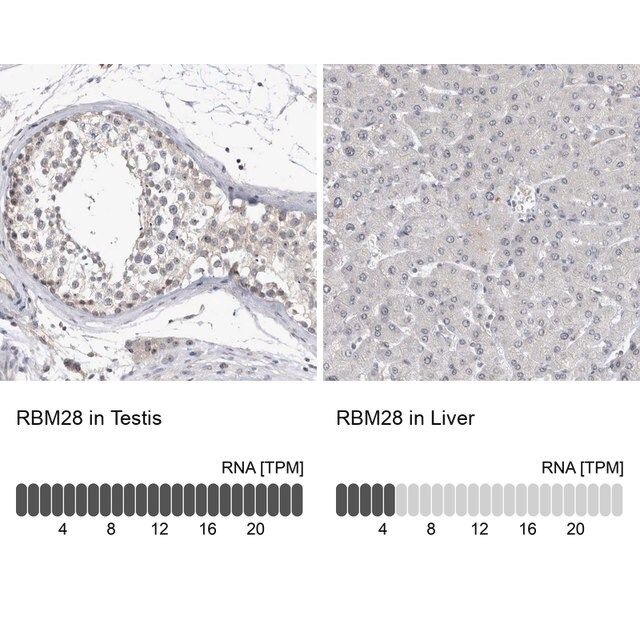 Anti-RBM28 antibody produced in rabbit