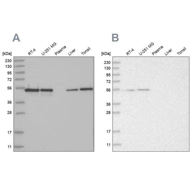 Anti-RBM17 antibody produced in rabbit