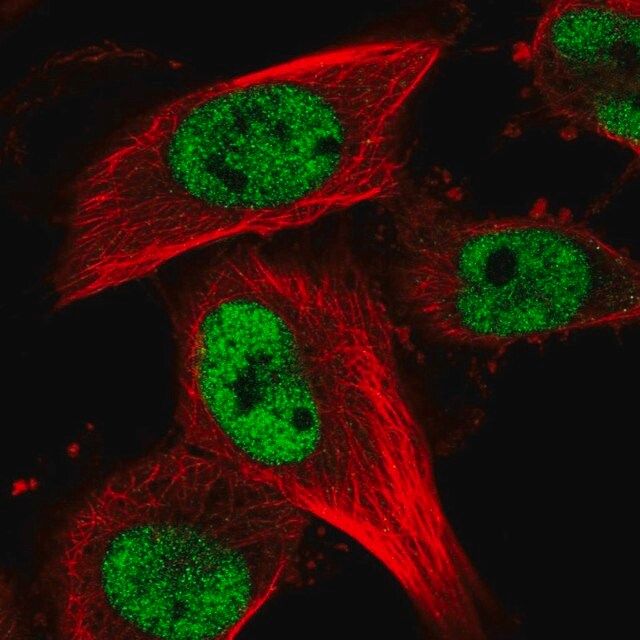 Anti-RBM15B antibody produced in rabbit