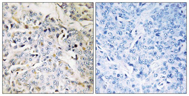 Anti-RBM34 antibody produced in rabbit