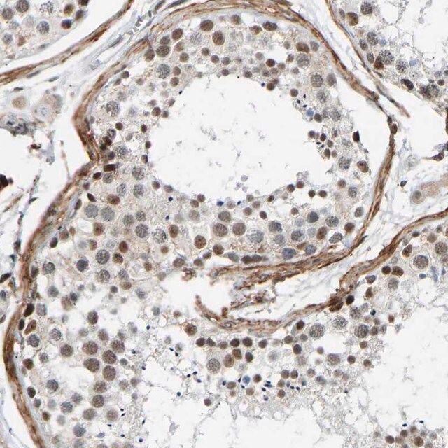 Anti-RBM15 antibody produced in rabbit