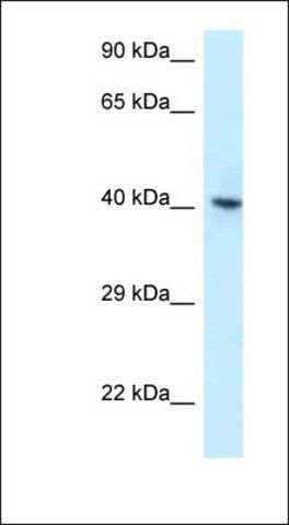 Anti-RBMX antibody produced in rabbit