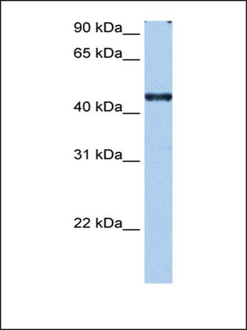 Anti-RBM42 antibody produced in rabbit