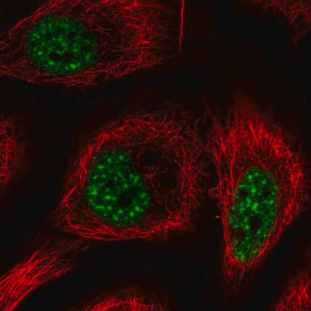 Anti-RBM25 antibody produced in rabbit