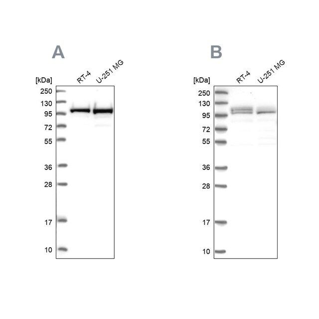 Anti-RBM12 antibody produced in rabbit