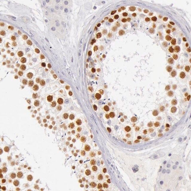 Anti-RBMY1A1 antibody produced in rabbit