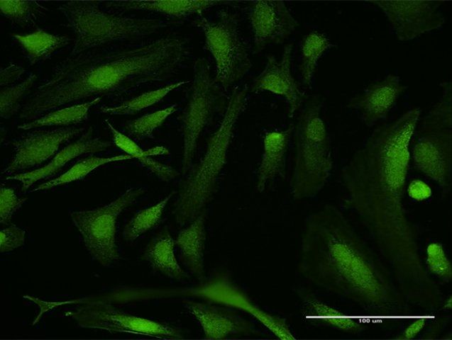 Anti-RBMY1A1 antibody produced in mouse