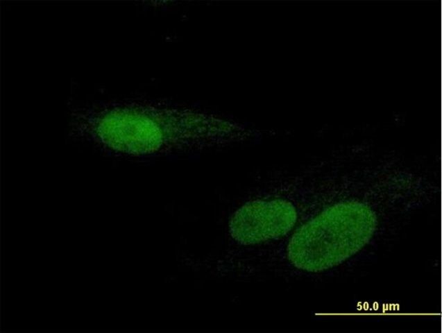 Anti-RBMY1F antibody produced in mouse