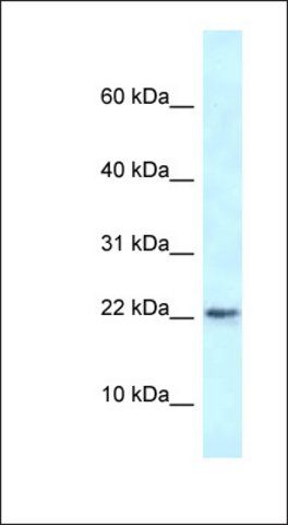 Anti-RBM3 antibody produced in rabbit