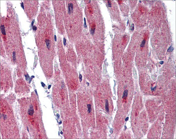 Anti-RBM24 antibody produced in rabbit