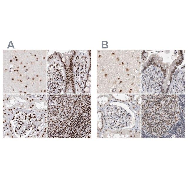 Anti-RBM6 antibody produced in rabbit