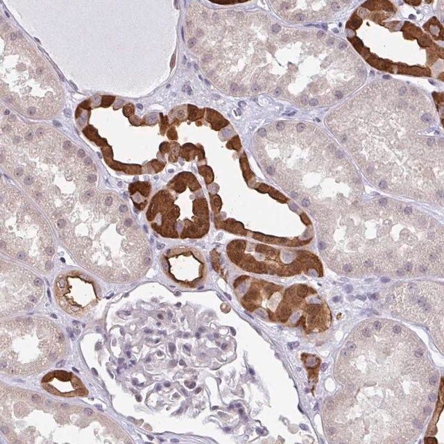 Anti-RBM18 antibody produced in rabbit