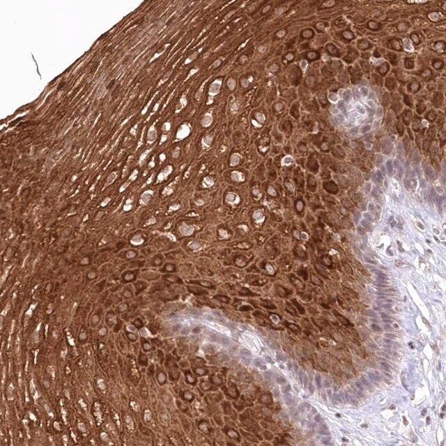 Anti-RBM27 antibody produced in rabbit