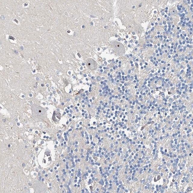 Anti-RBM43 antibody produced in rabbit