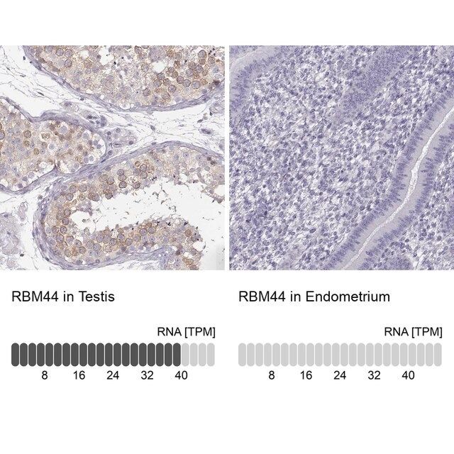 Anti-RBM44 antibody produced in rabbit