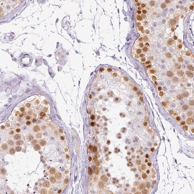 Anti-RBMY1F antibody produced in rabbit