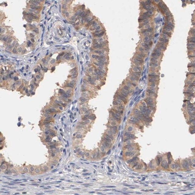 Anti-RBM23 antibody produced in rabbit