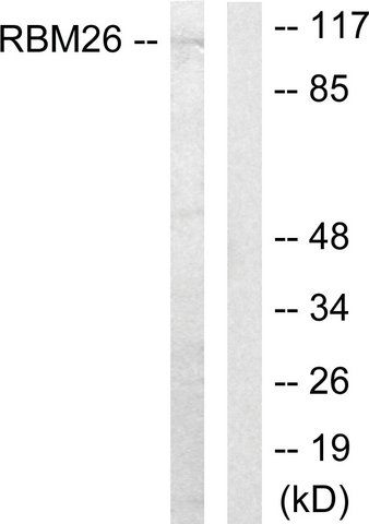 Anti-RBM26 antibody produced in rabbit