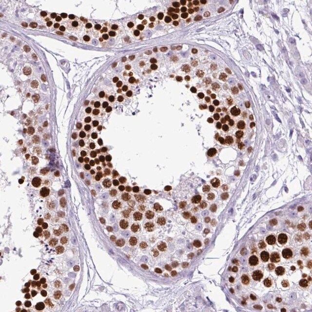 Anti-RBMXL2 antibody produced in rabbit