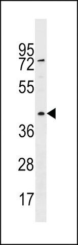 ANTI-RBMXL1 (CENTER) antibody produced in rabbit