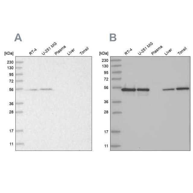 Anti-RBM17 antibody produced in rabbit