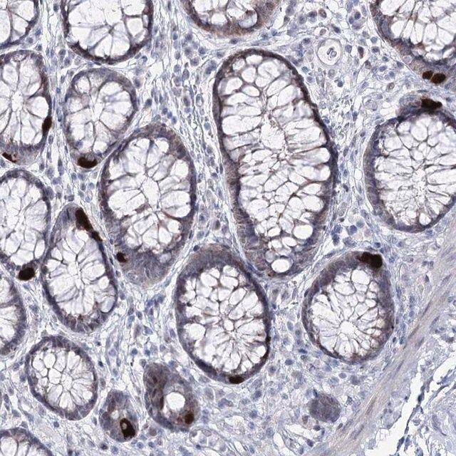 Anti-RBM15B antibody produced in rabbit