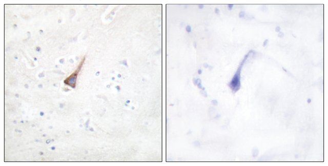 ANTI-PTP1B antibody produced in rabbit