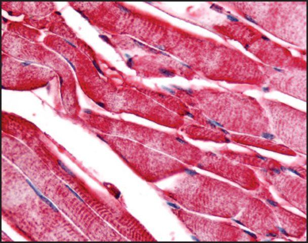 Anti-PYGM antibody produced in rabbit