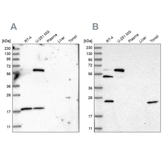 Anti-PYROXD2 antibody produced in rabbit